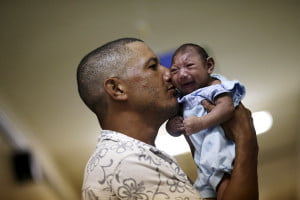 zika-brasil microcefalea